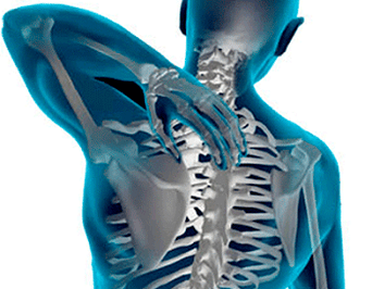 Manifestaciones de la osteocondrosis de la columna torácica