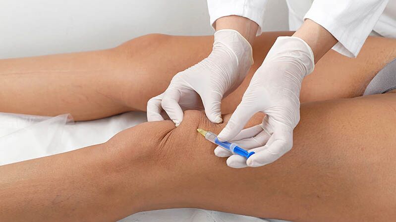 Inyección intraarticular para la artrosis de la rodilla